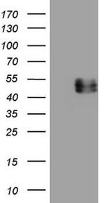 IL12B Antibody in Western Blot (WB)