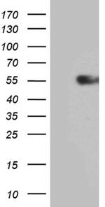 IL15RA Antibody in Western Blot (WB)