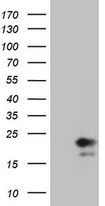 IL17B Antibody in Western Blot (WB)