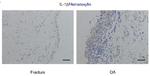 IL1B Antibody in Immunohistochemistry (Paraffin) (IHC (P))