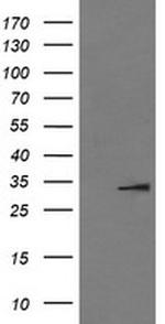IL1B Antibody in Western Blot (WB)