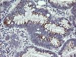 IL1F9 Antibody in Immunohistochemistry (Paraffin) (IHC (P))