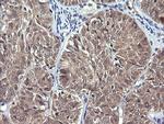 IL1F9 Antibody in Immunohistochemistry (Paraffin) (IHC (P))