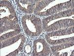 IL1F9 Antibody in Immunohistochemistry (Paraffin) (IHC (P))