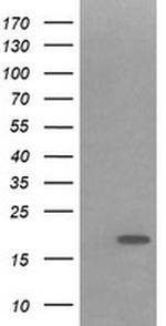 IL1F9 Antibody in Western Blot (WB)