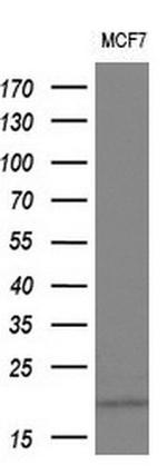 IL1F9 Antibody in Western Blot (WB)