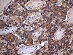 IL1RN Antibody in Immunohistochemistry (Paraffin) (IHC (P))