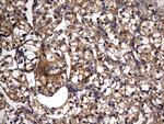 IL1RN Antibody in Immunohistochemistry (Paraffin) (IHC (P))