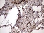 IL1RN Antibody in Immunohistochemistry (Paraffin) (IHC (P))