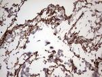 IL1RN Antibody in Immunohistochemistry (Paraffin) (IHC (P))