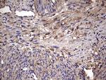 IL1RN Antibody in Immunohistochemistry (Paraffin) (IHC (P))