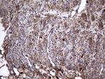 IL1RN Antibody in Immunohistochemistry (Paraffin) (IHC (P))