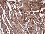 IL1RN Antibody in Immunohistochemistry (Paraffin) (IHC (P))