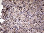 IL1RN Antibody in Immunohistochemistry (Paraffin) (IHC (P))