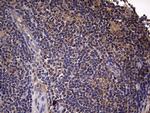 IL1RN Antibody in Immunohistochemistry (Paraffin) (IHC (P))