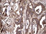 IL1RN Antibody in Immunohistochemistry (Paraffin) (IHC (P))