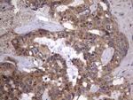 IL1RN Antibody in Immunohistochemistry (Paraffin) (IHC (P))