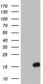 IL1RN Antibody in Western Blot (WB)