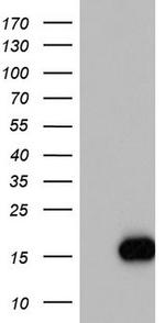 IL1RN Antibody in Western Blot (WB)