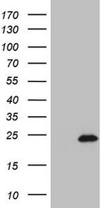 IL20 Antibody in Western Blot (WB)