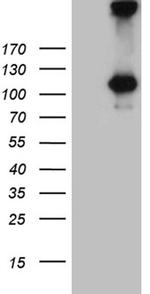 IL20RA Antibody in Western Blot (WB)