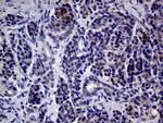 IL24 Antibody in Immunohistochemistry (Paraffin) (IHC (P))