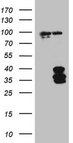 IL34 Antibody in Western Blot (WB)