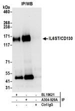 IL6ST/CD130 Antibody in Western Blot (WB)