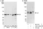 ILK Antibody in Western Blot (WB)