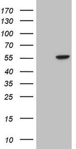 ILK Antibody in Western Blot (WB)