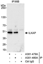 ILKAP Antibody in Immunoprecipitation (IP)