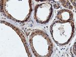 ILVBL Antibody in Immunohistochemistry (Paraffin) (IHC (P))