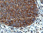 ILVBL Antibody in Immunohistochemistry (Paraffin) (IHC (P))