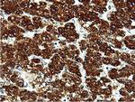 ILVBL Antibody in Immunohistochemistry (Paraffin) (IHC (P))