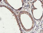 ILVBL Antibody in Immunohistochemistry (Paraffin) (IHC (P))