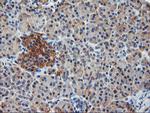 ILVBL Antibody in Immunohistochemistry (Paraffin) (IHC (P))