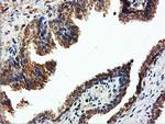 ILVBL Antibody in Immunohistochemistry (Paraffin) (IHC (P))