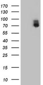 ILVBL Antibody in Western Blot (WB)