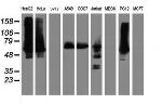 ILVBL Antibody in Western Blot (WB)