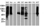 ILVBL Antibody in Western Blot (WB)