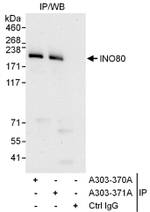 INO80 Antibody in Immunoprecipitation (IP)