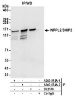 INPPL1/SHIP2 Antibody in Western Blot (WB)