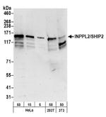 INPPL1/SHIP2 Antibody in Western Blot (WB)