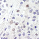 INT8 Antibody in Immunohistochemistry (IHC)