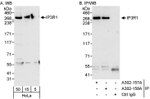 IP3R1 Antibody in Western Blot (WB)