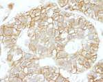 IQGAP1 Antibody in Immunohistochemistry (IHC)