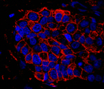 IQGAP1 Antibody in Immunohistochemistry (IHC)