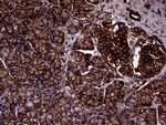 IQGAP1 Antibody in Immunohistochemistry (Paraffin) (IHC (P))