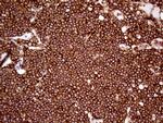 IQGAP1 Antibody in Immunohistochemistry (Paraffin) (IHC (P))