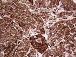 IQGAP1 Antibody in Immunohistochemistry (Paraffin) (IHC (P))